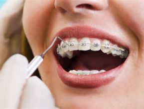Planes de cobertura odontologica